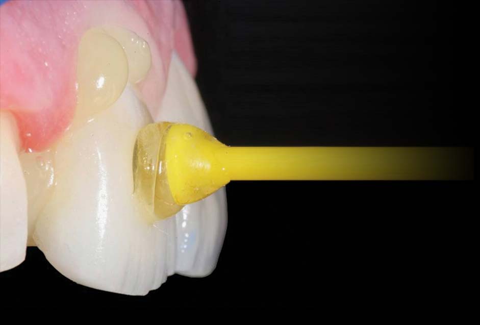 Concrete Results Arrowhead Dental Laboratory