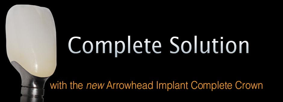 Arrowhead's Implant Complete Crown